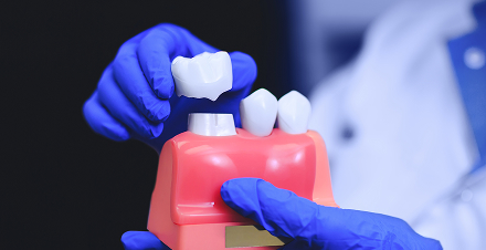 Free Dental Implant Consultation