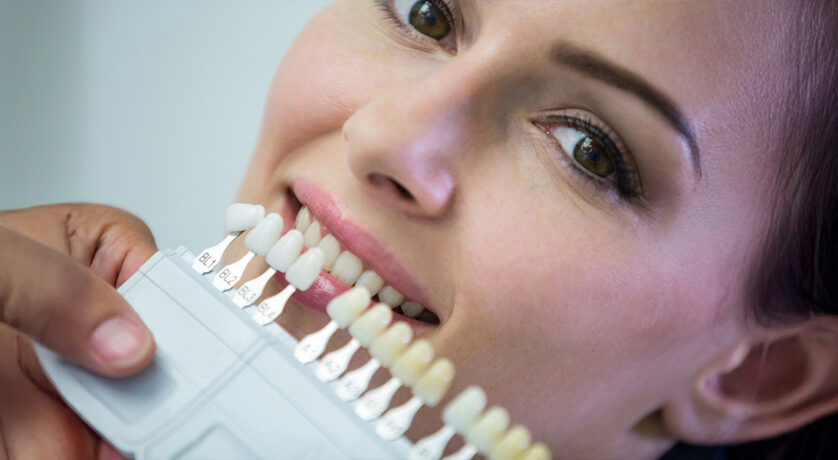 Why Porcelain Crowns Are a Top Choice for Repairing Damaged Teeth?